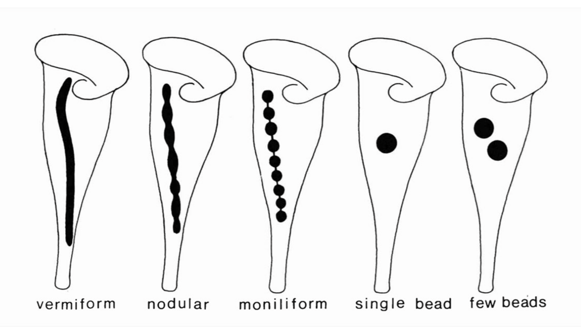 Macronuclear shapes in different stentor species