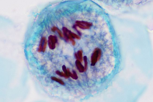 Meiosis during anaphase, after homologous chromosomes have exchanged alleles and are pulled apart