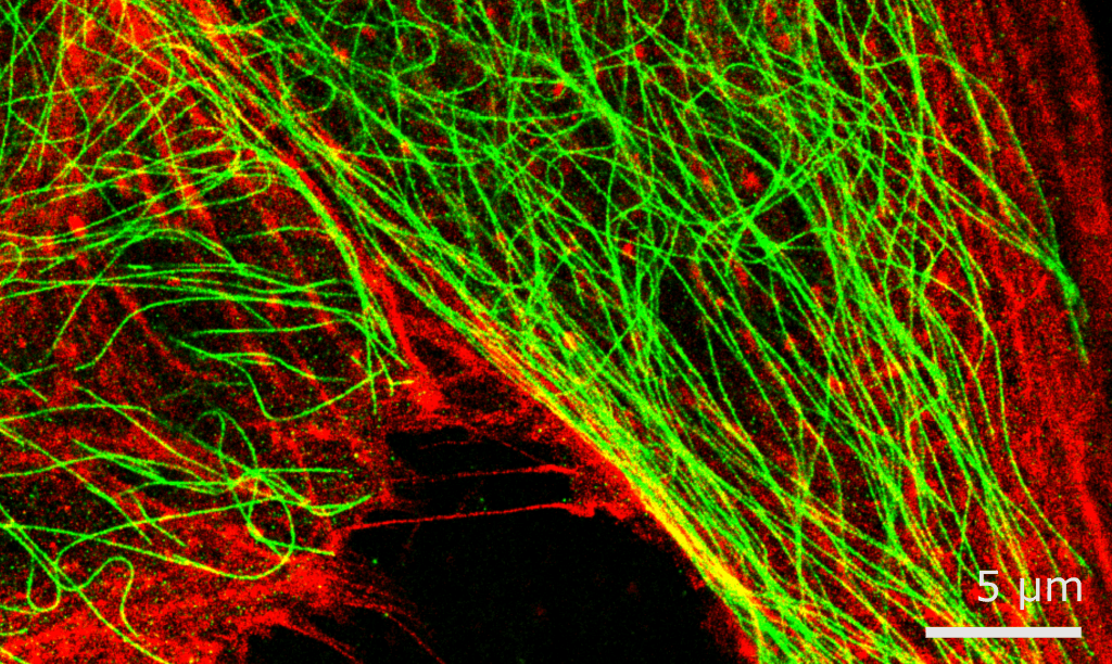 Disruptive Science & The Electron Microscopy Revolution